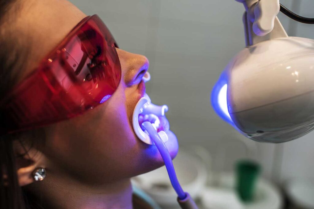 blanqueamiento dental en Zaragoza, blanqueamiento dental ambulatorio en Zaragoza, blanqueamiento dental en clínica en Zaragoza, blanqueamiento combinado en Zaragoza.