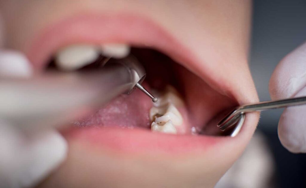 odontopediatría en Zaragoza, dentista para niños en Zaragoza, clínica dental para niños en Zaragoza, odontólogo para niños en Zaragoza, odontología para niños en Zaragoza.