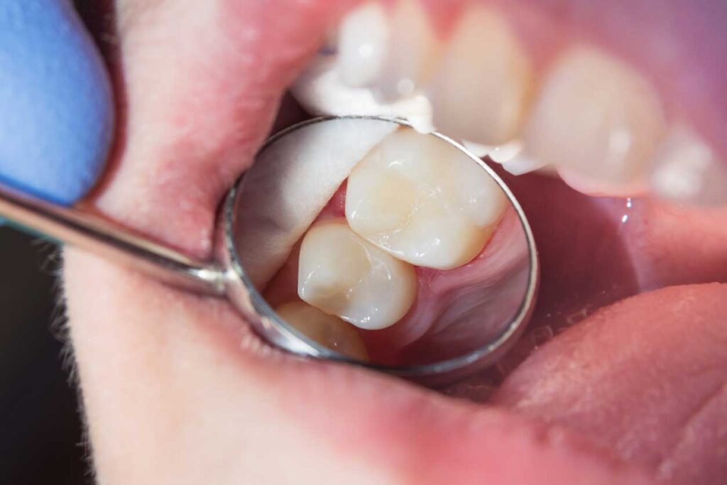 Cuida la salud de tu boca con nuestra Odontología general en Zaragoza. ¡Soluciones innovadoras a medida para tener una sonrisa de confianza!
