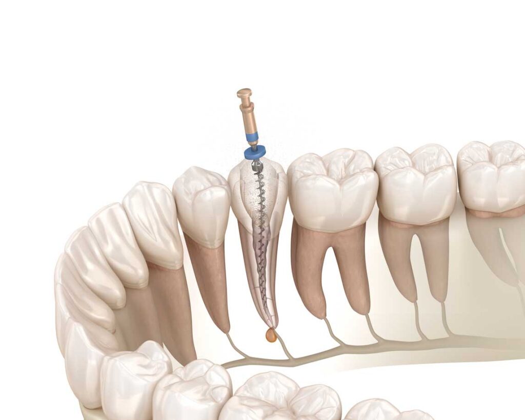 Cuida la salud de tu boca con nuestra Odontología general en Zaragoza. ¡Soluciones innovadoras a medida para tener una sonrisa de confianza!