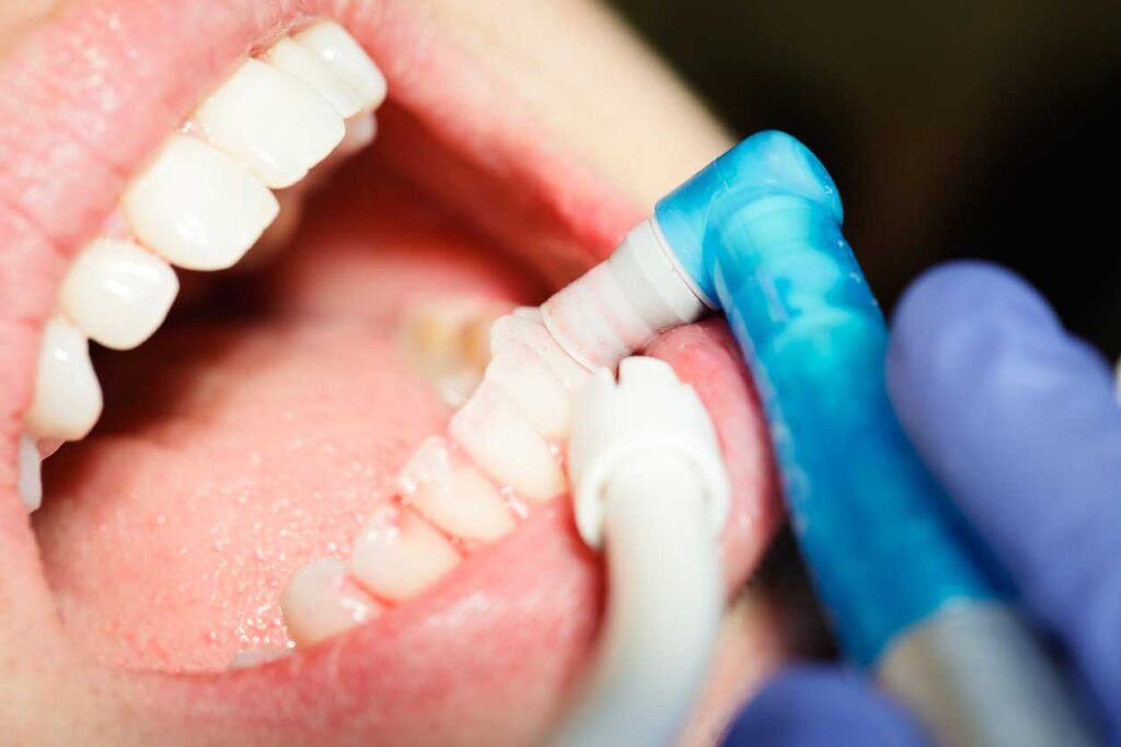 periodoncia en Zaragoza, tratamiento para las encías en Zaragoza, tratamiento para la enfermedad de las encías en Zaragoza.