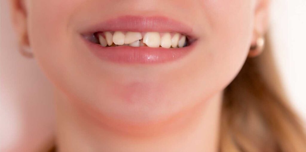 odontopediatría en Zaragoza, dentista para niños en Zaragoza, clínica dental para niños en Zaragoza, odontólogo para niños en Zaragoza, odontología para niños en Zaragoza.