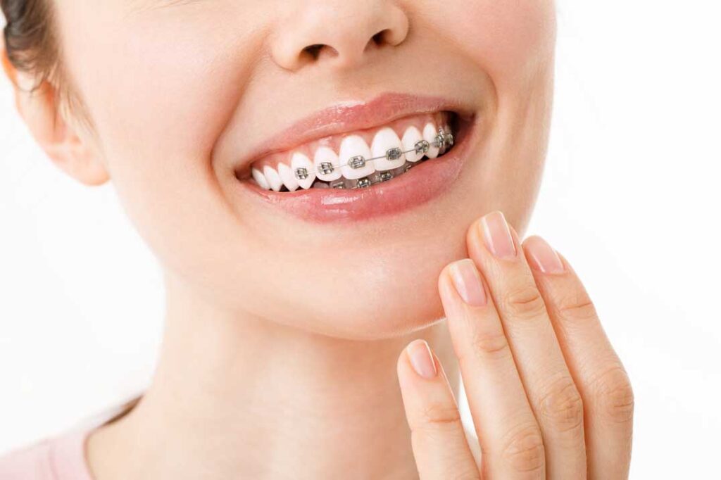 ortodoncia en Zaragoza, brackets en Zaragoza, brackets autoligados en Zaragoza, ortodoncia invisible en Zaragoza, Invisalign en Zaragoza, ortodoncia interceptiva en Zaragoza, ortodoncia para niños.