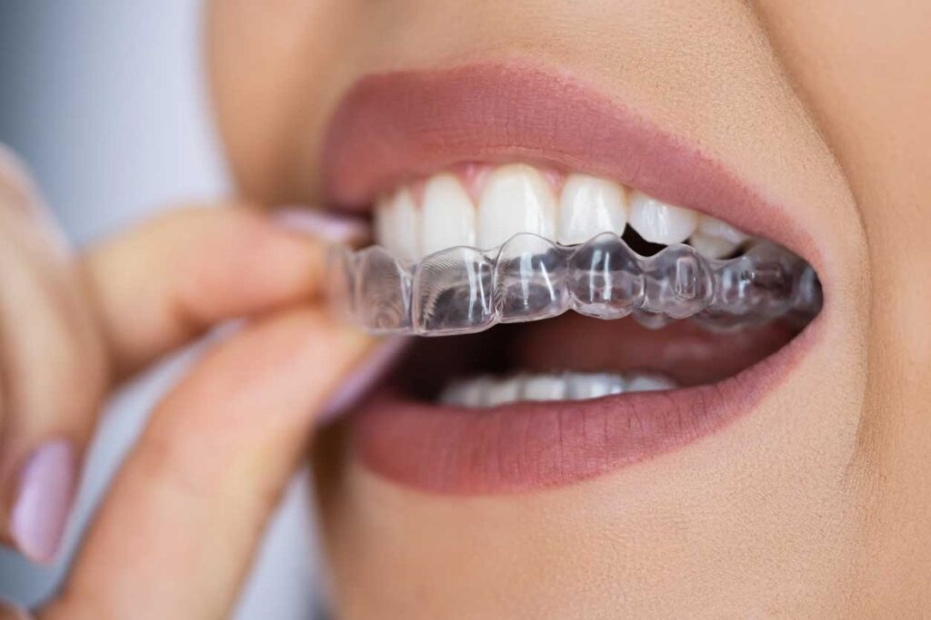 ortodoncia en Zaragoza, brackets en Zaragoza, brackets autoligados en Zaragoza, ortodoncia invisible en Zaragoza, Invisalign en Zaragoza, ortodoncia interceptiva en Zaragoza, ortodoncia para niños.