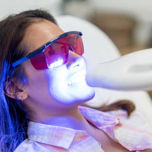 blanqueamiento blanqueamiento dental en Zaragoza, blanqueamiento dental ambulatorio en Zaragoza, blanqueamiento dental en clínica en Zaragoza, blanqueamiento combinado en Zaragoza.
