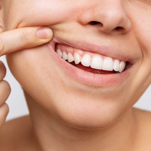 periodoncias periodoncia en Zaragoza, tratamiento para las encías en Zaragoza, tratamiento para la enfermedad de las encías en Zaragoza.