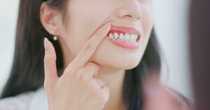 Enfermedad periodontal y pérdida de dientes